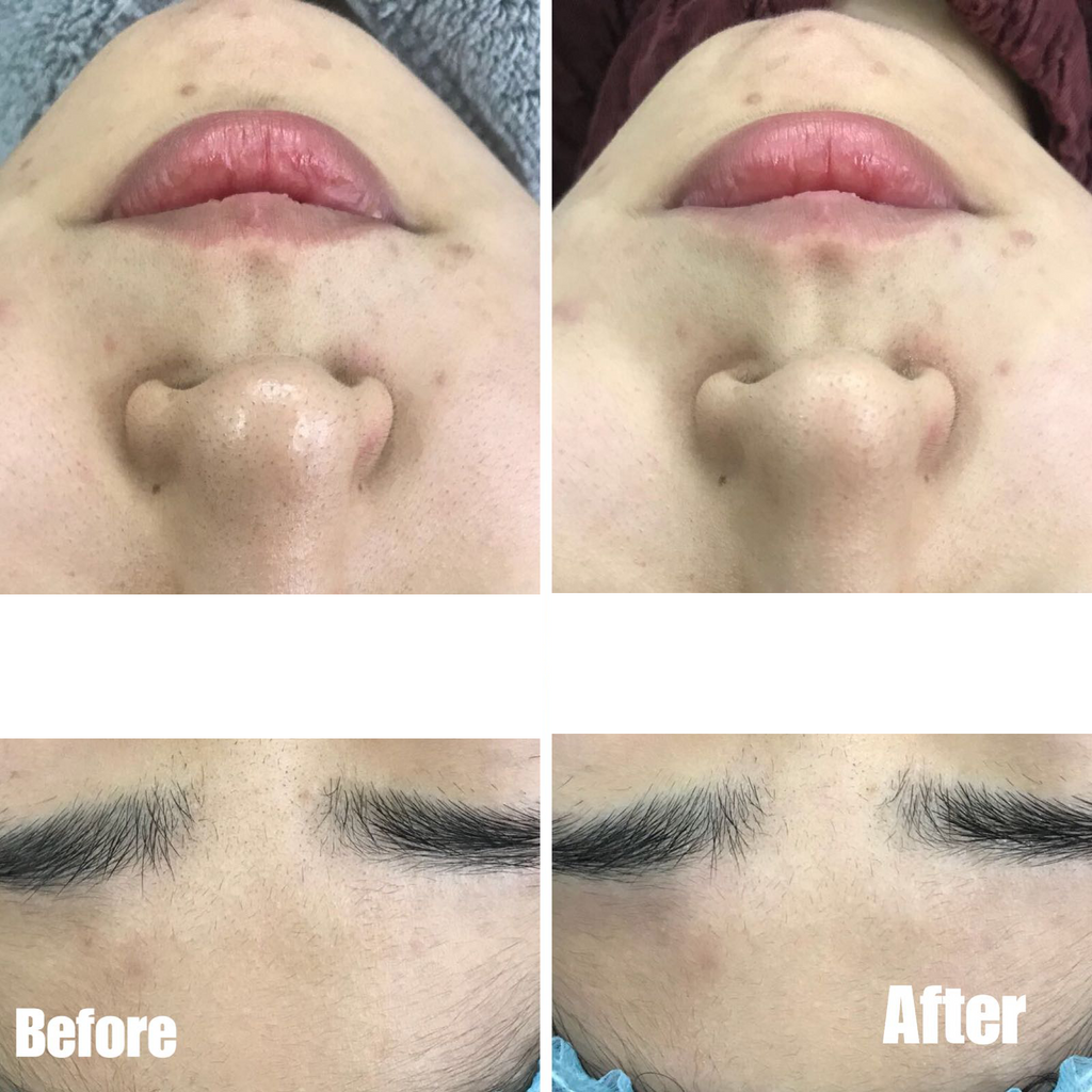 sMTS Crystal Mask Pack Kit - 5pcs/ box