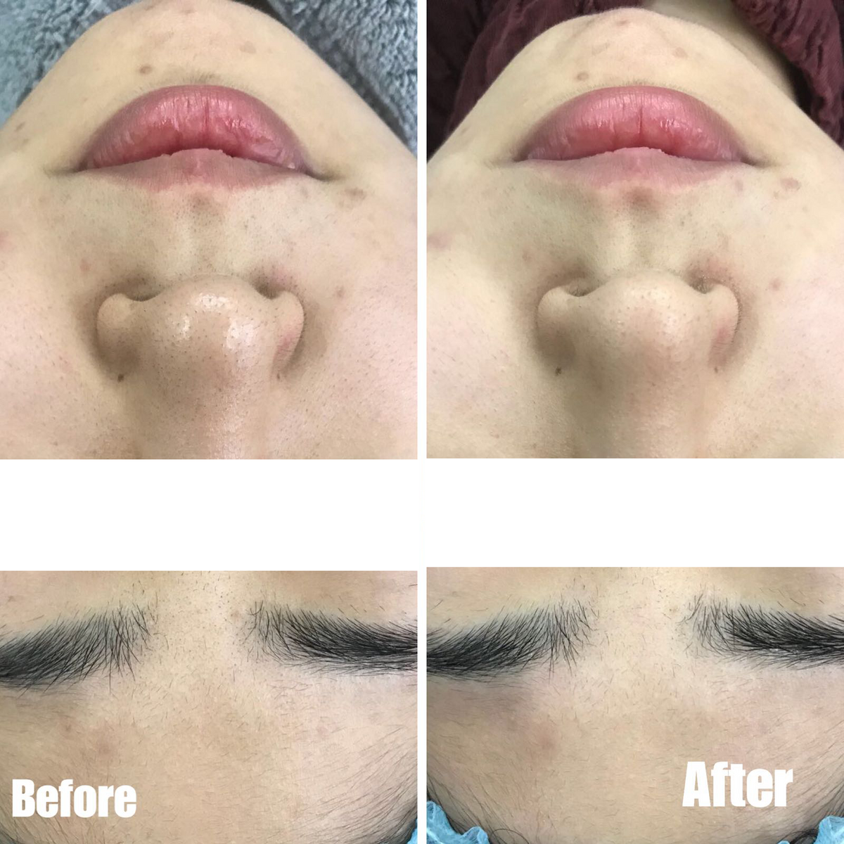 sMTS Crystal Mask Pack Kit - 5pcs/ box